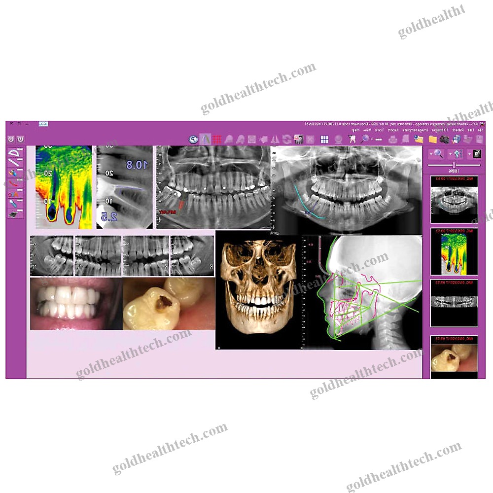 Dental Imaging Software
