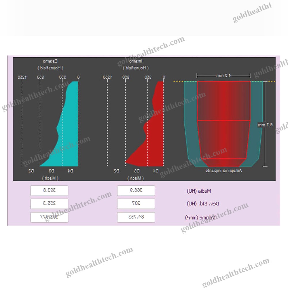 Dental Imaging Software