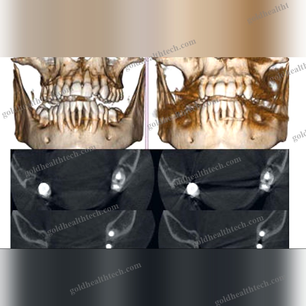Dental Imaging Software
