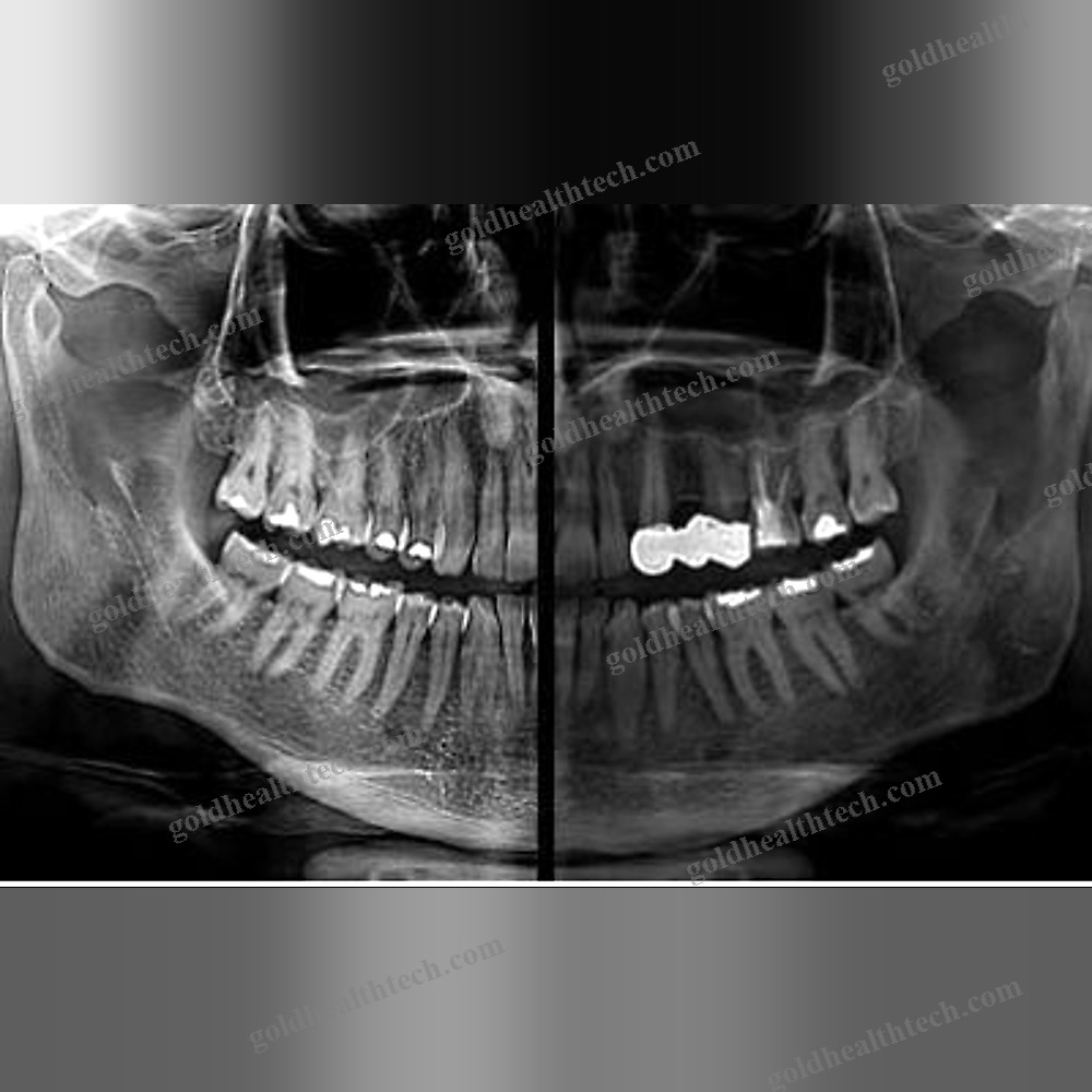 Dental Imaging Software