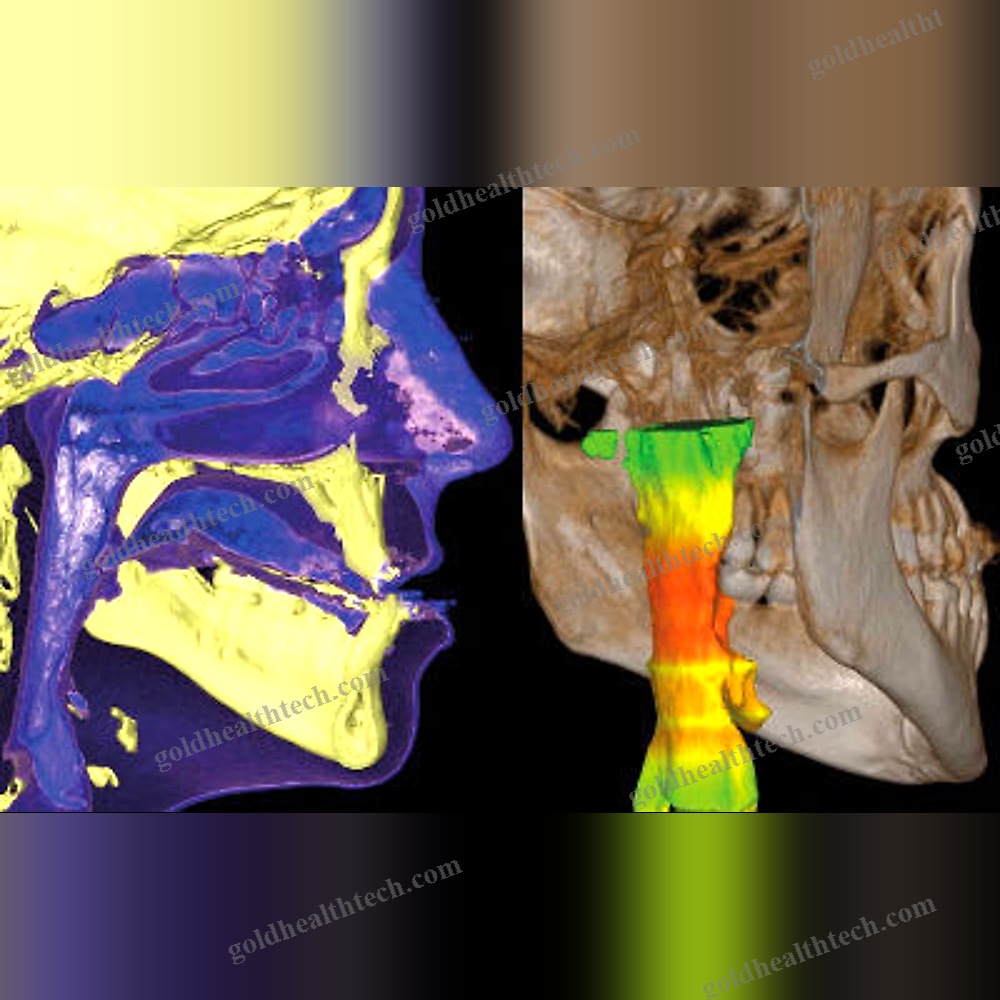 Dental Imaging Software