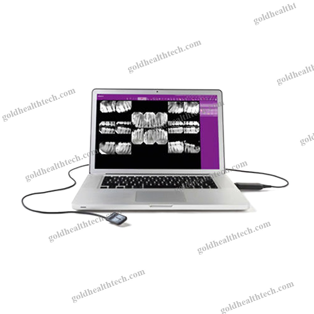 Dental Radiography Intra-Oral Detector