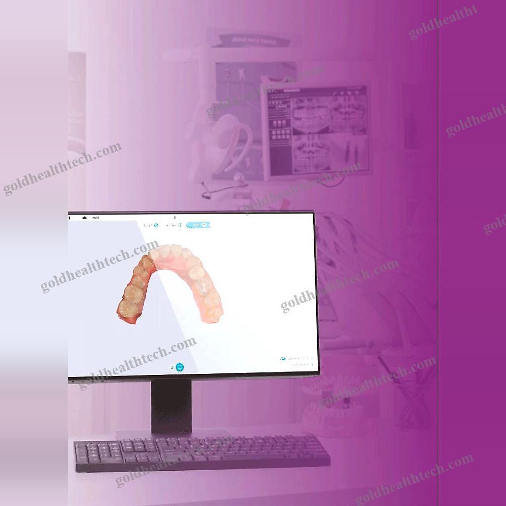 3D Dental Scanner
