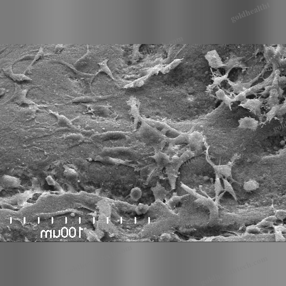 Xenograft Bone Substitute