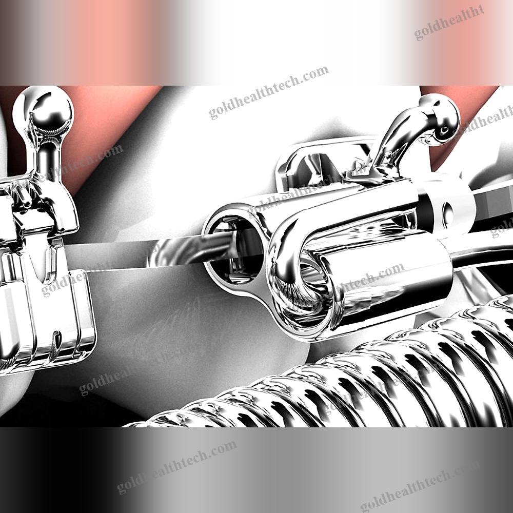 Buccal Tube