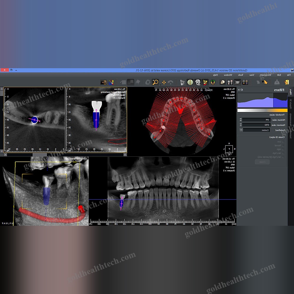 Dental Imaging Software