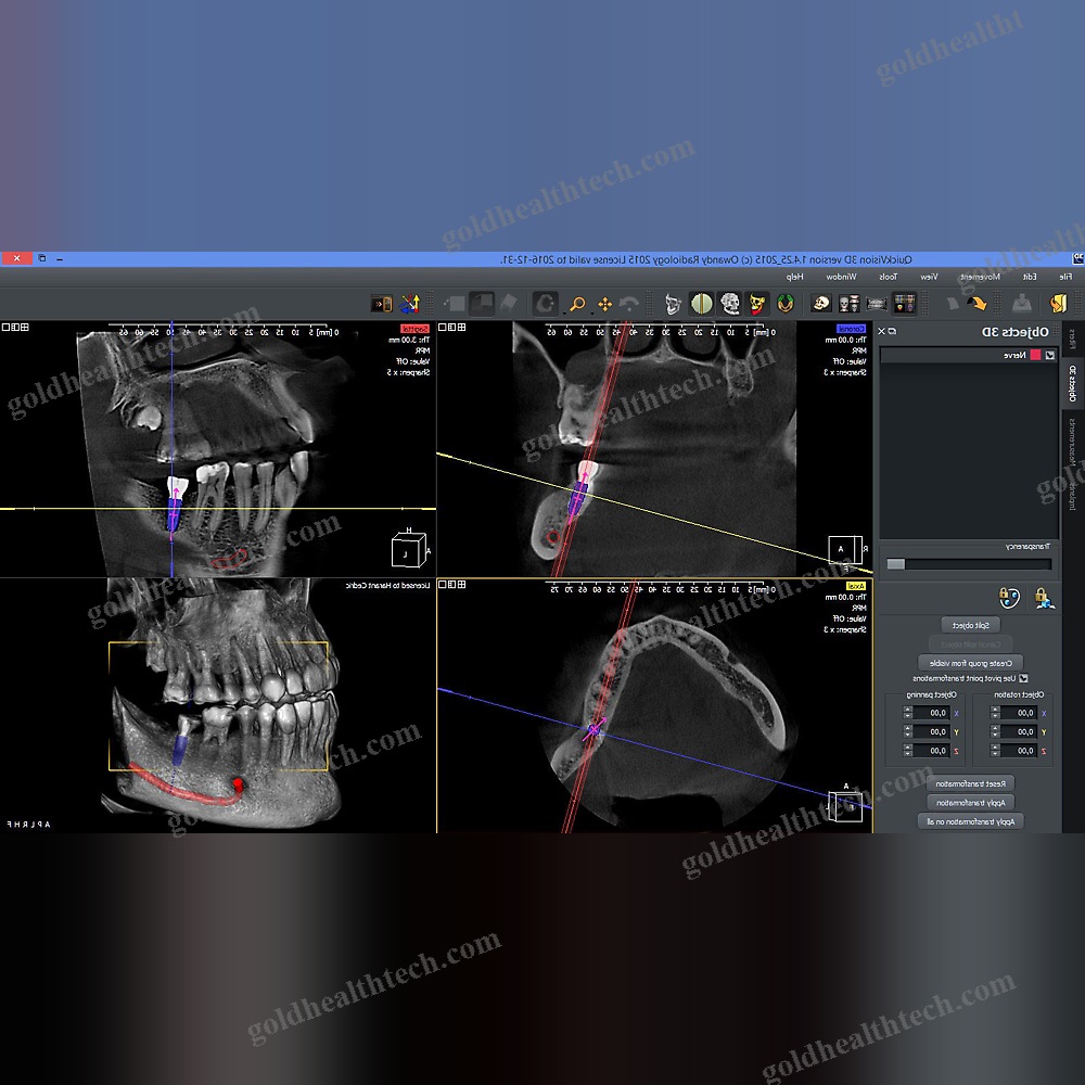 Dental Imaging Software