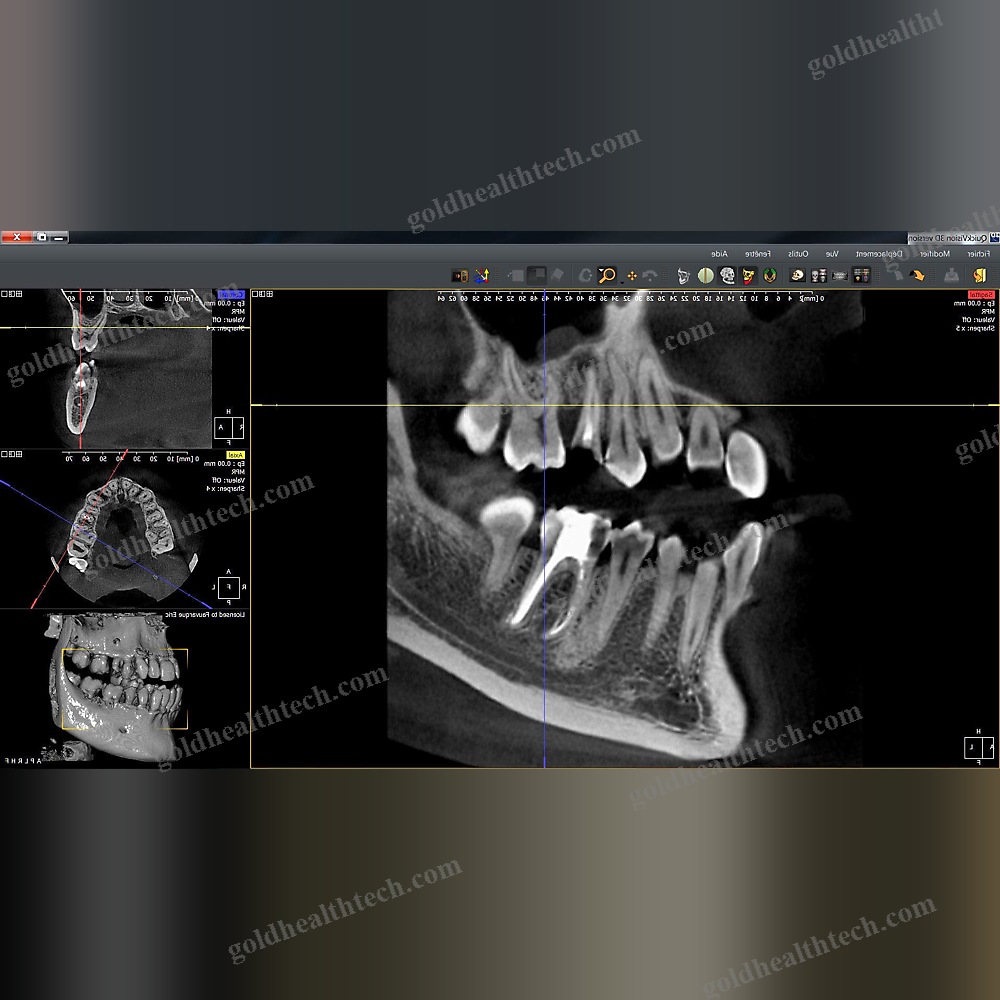 Dental Imaging Software