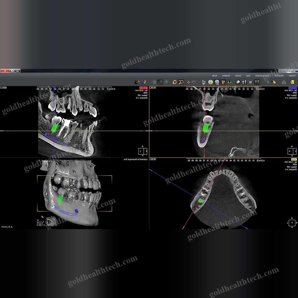 Dental Imaging Software