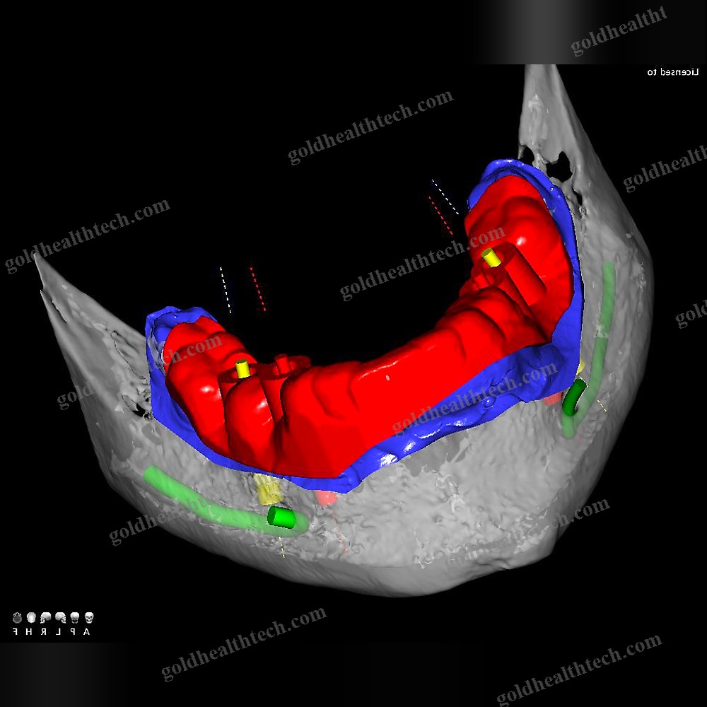 Dental Imaging Software