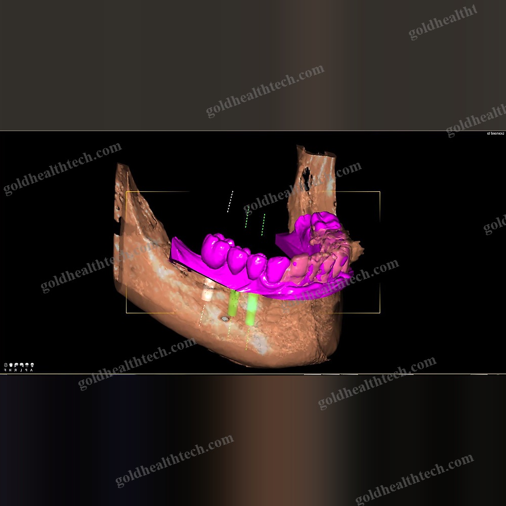 Dental Imaging Software
