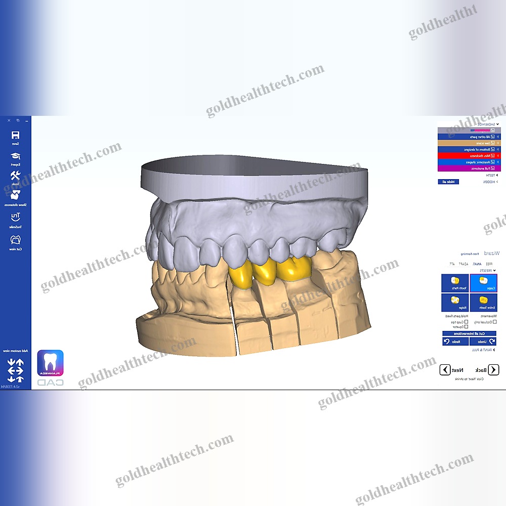 Dental Software