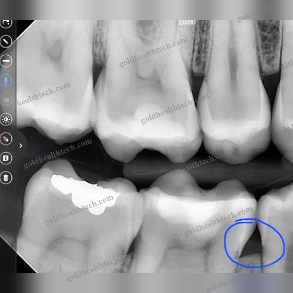 Dental Ios Application