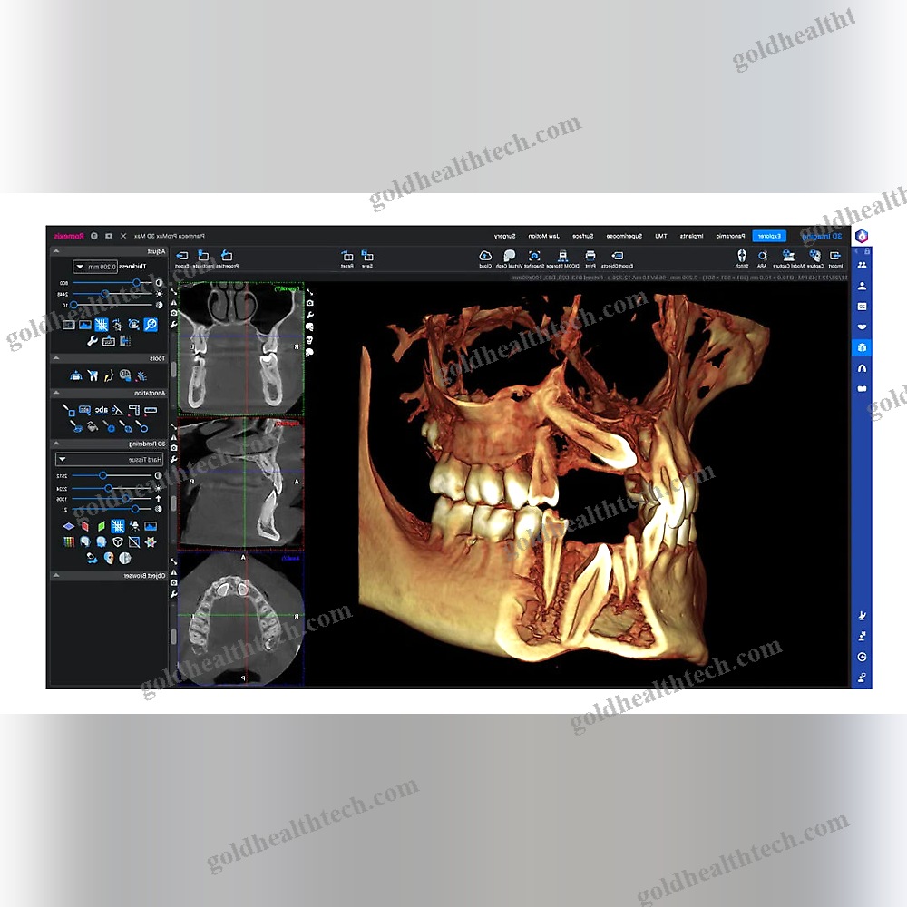 Medical Software