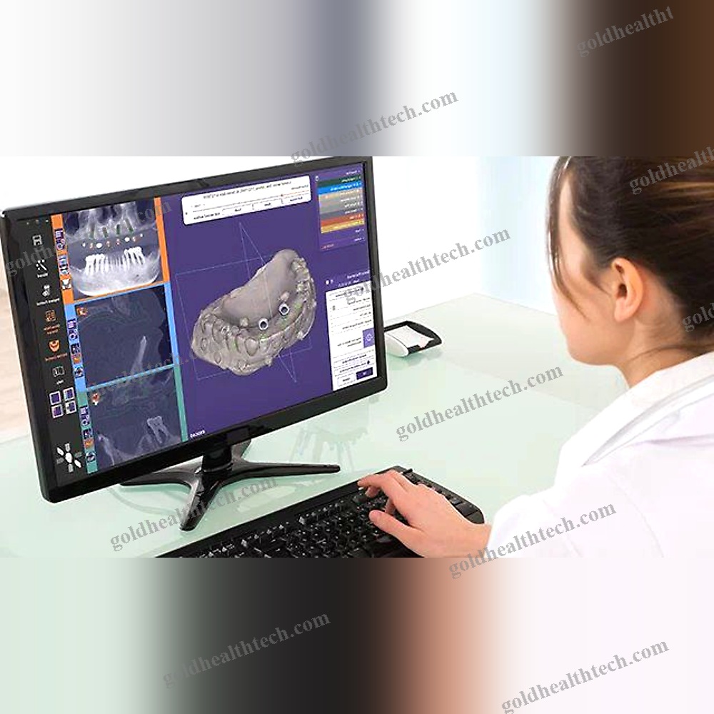 Dental Implantology Software