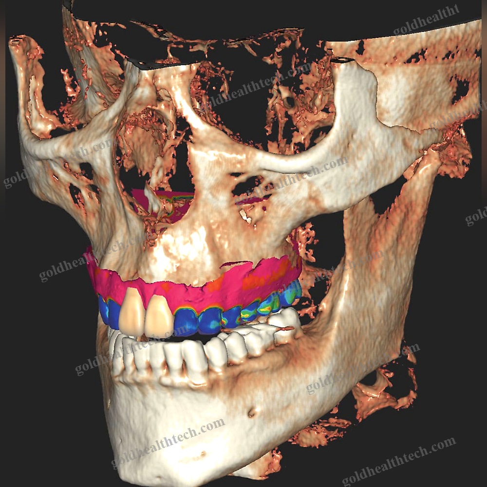 Dental Implantology Software