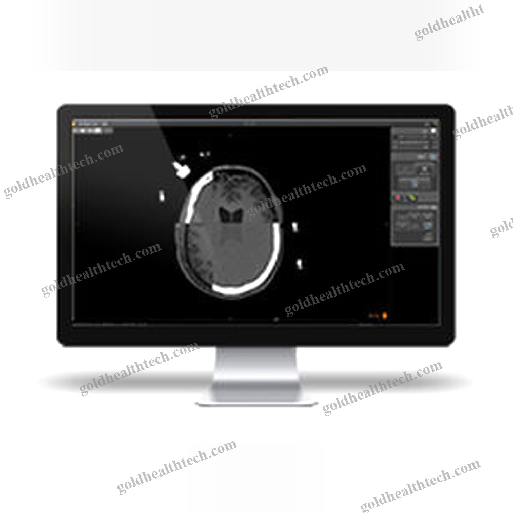 Preoperative Planning Software