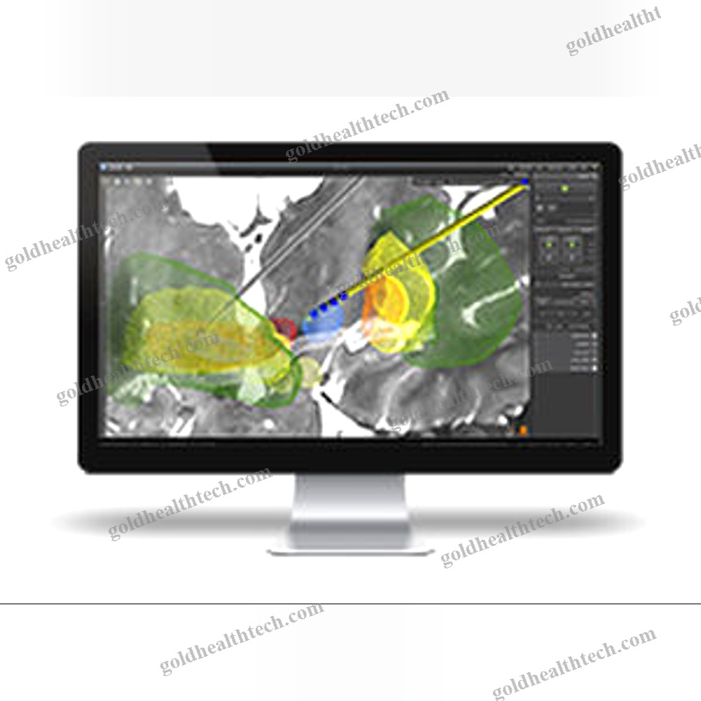 Preoperative Planning Software