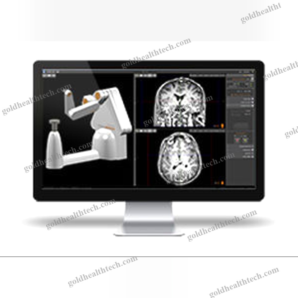 Preoperative Planning Software