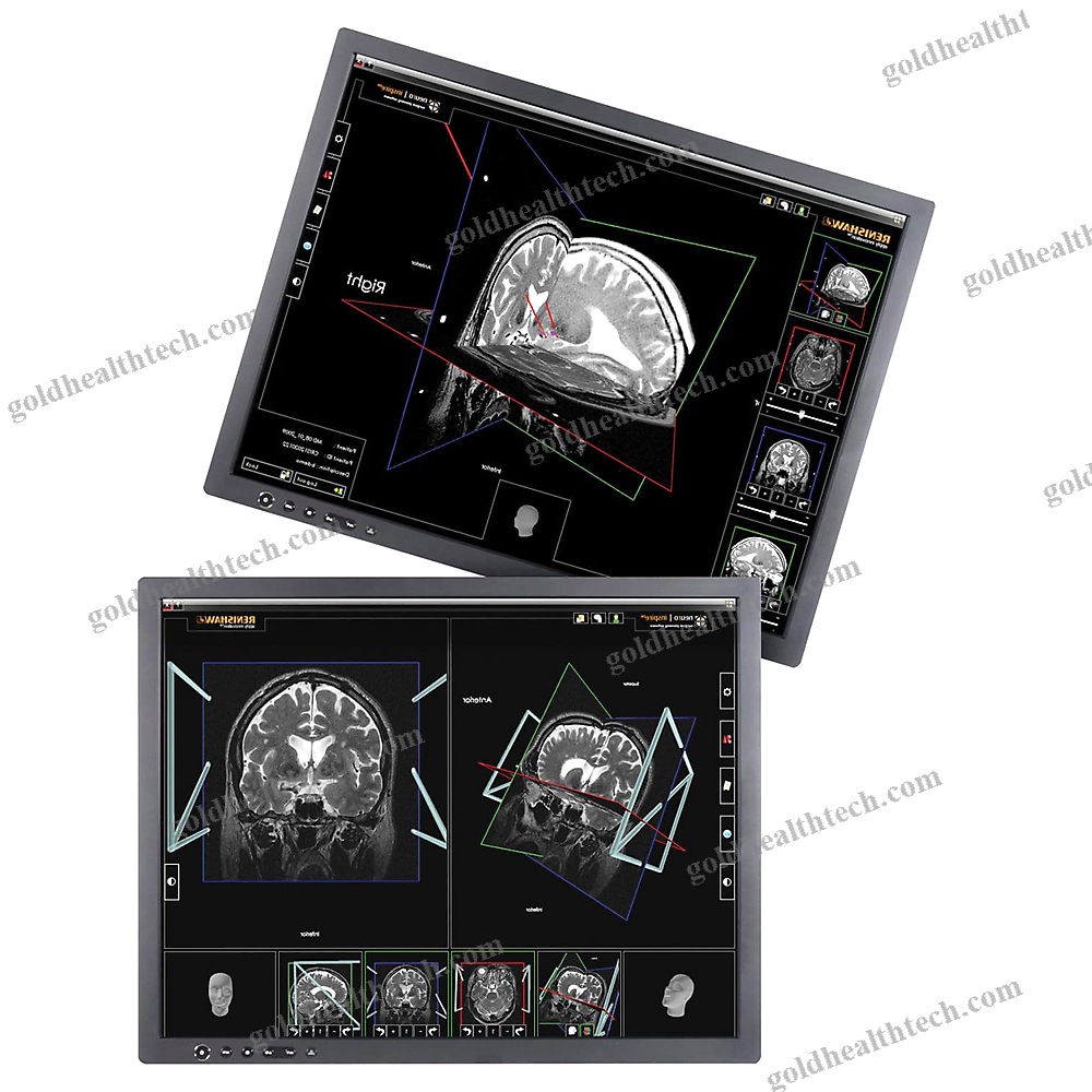 Preoperative Planning Software