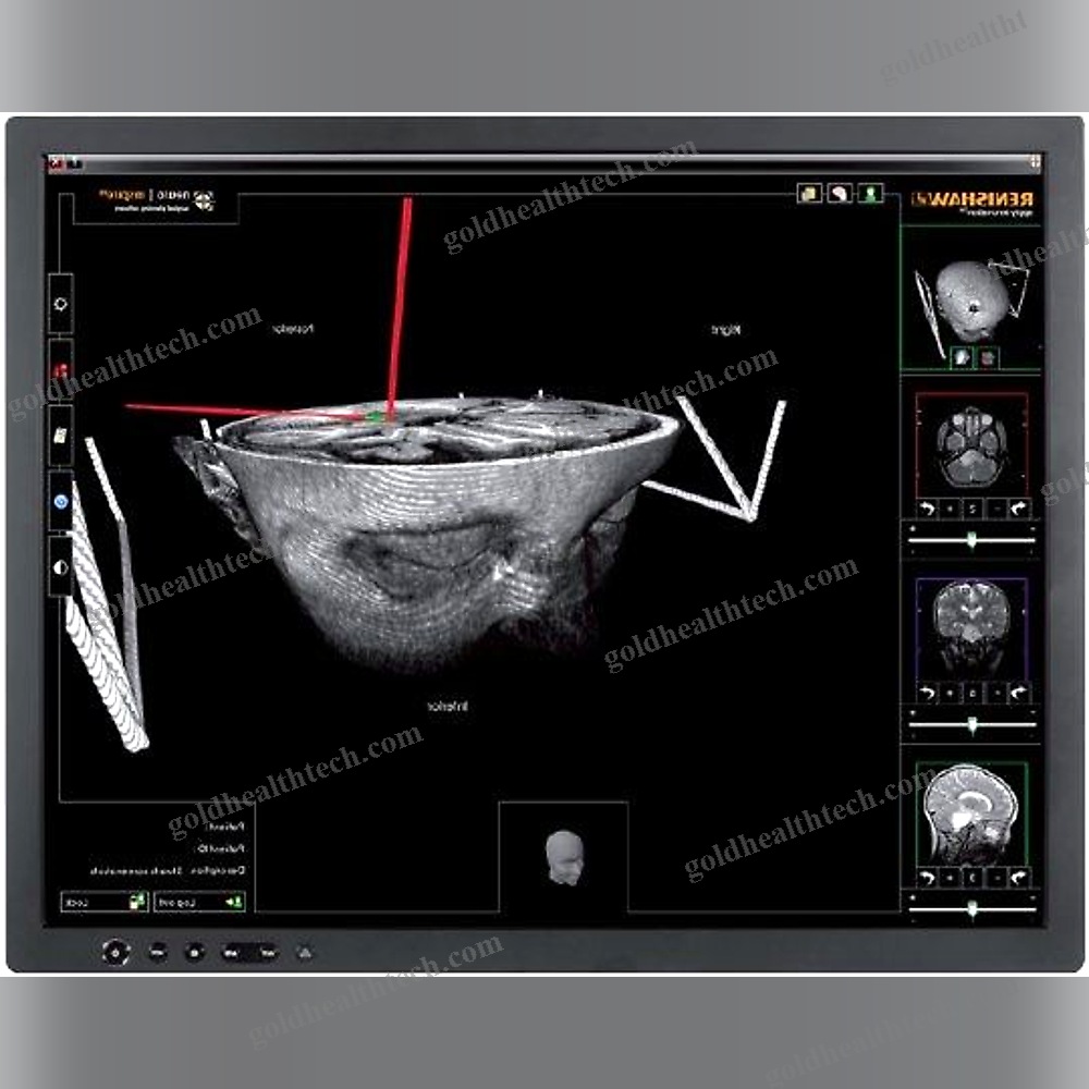 Preoperative Planning Software