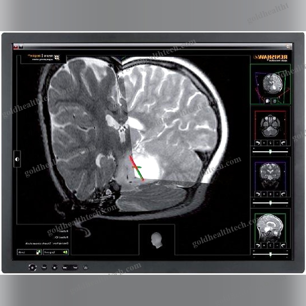Preoperative Planning Software