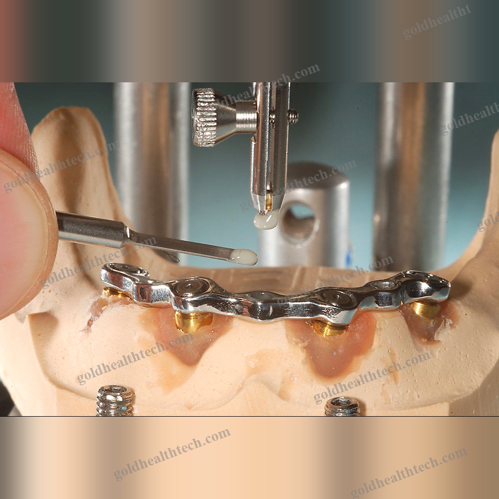 Titanium Dental Implant Sleeve