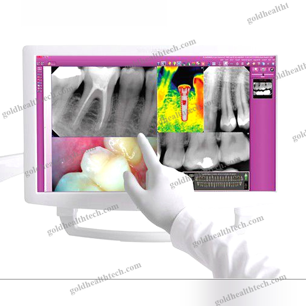 Dental Display