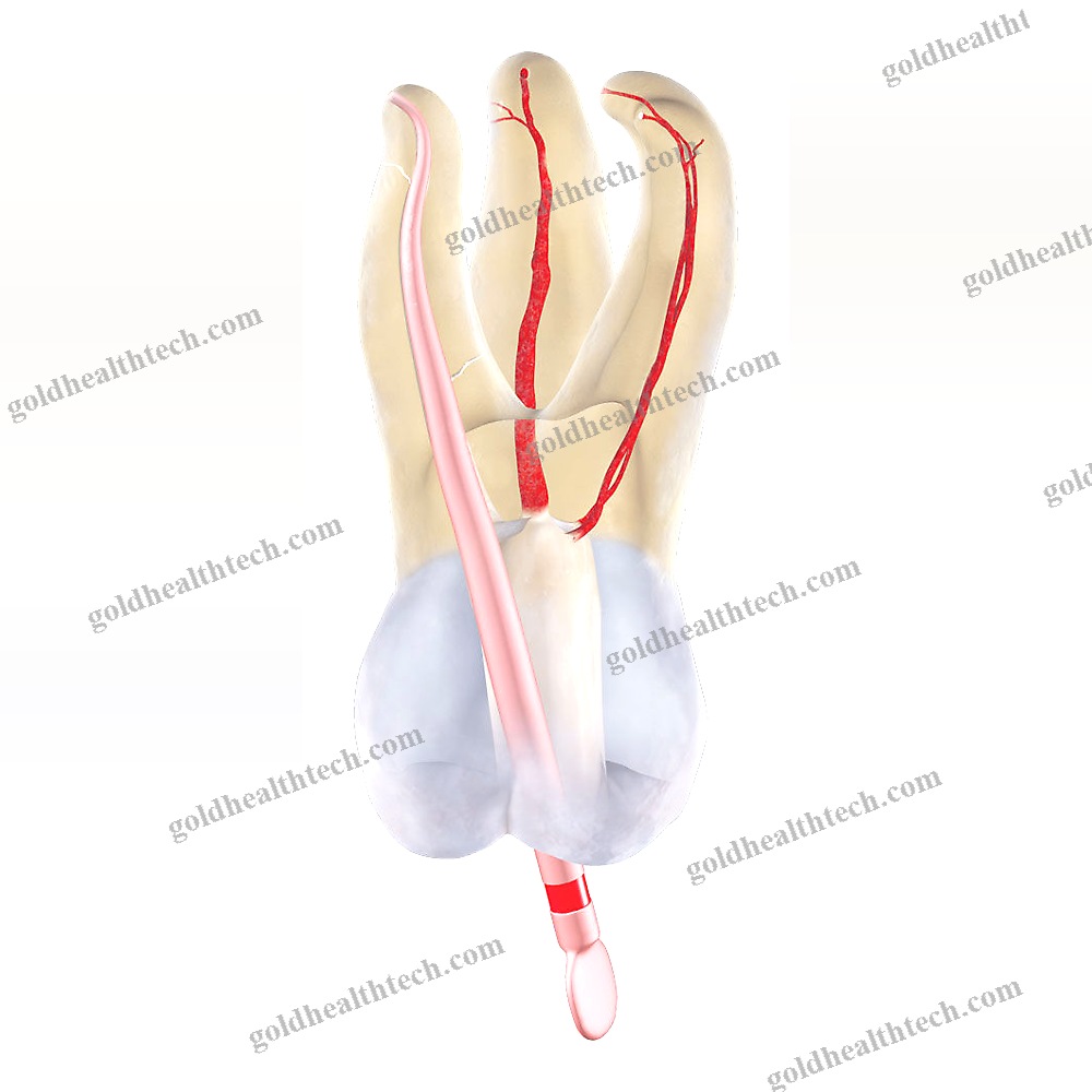 Gutta-Percha Cone