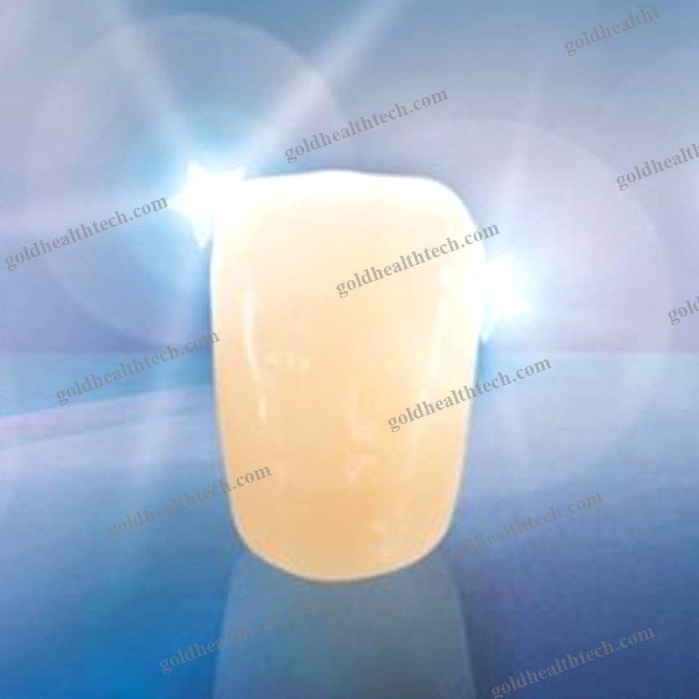 Composite Dental Prosthesis
