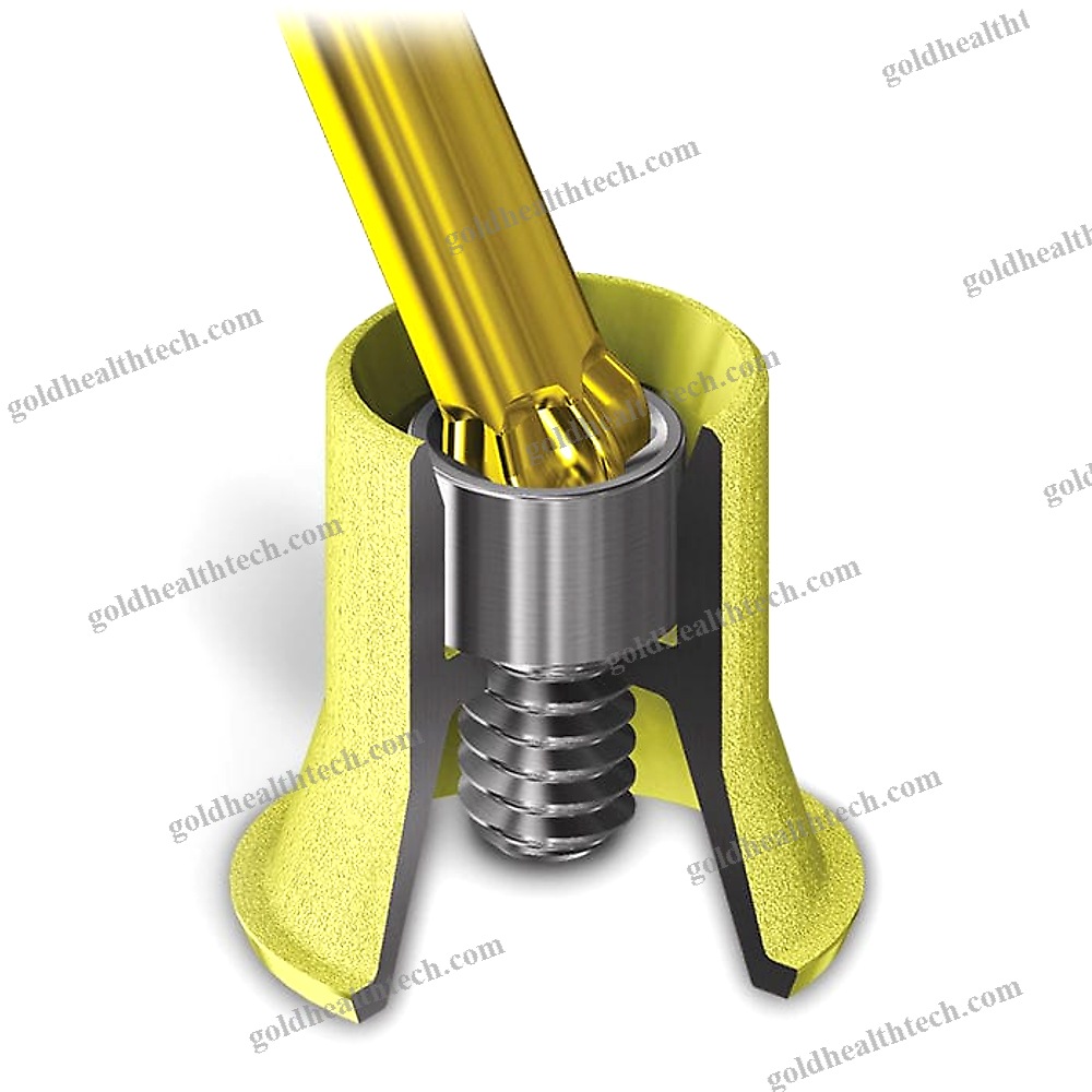 Titanium Implant Abutment