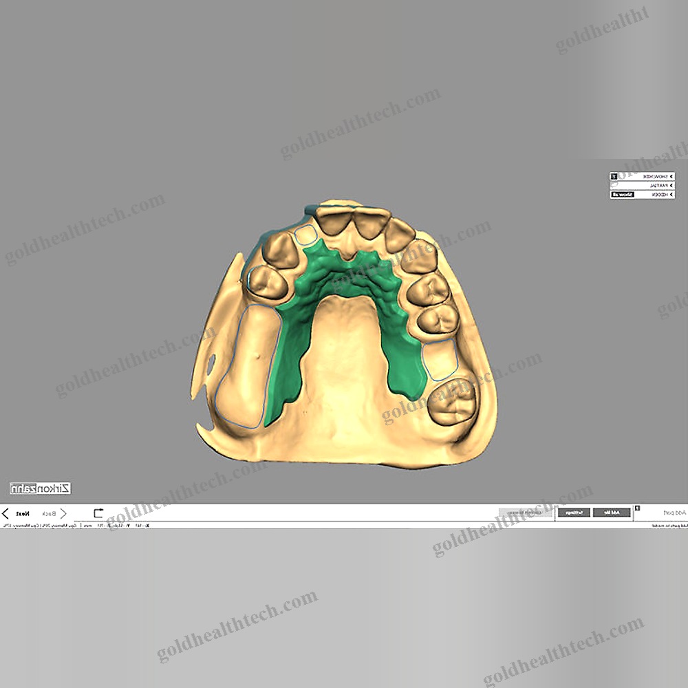 Dental Restoration Software