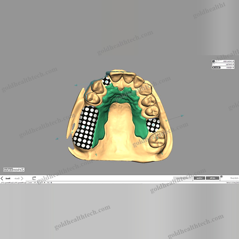 Dental Restoration Software