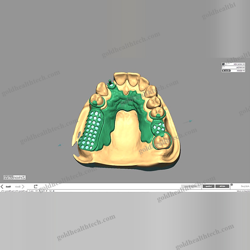 Dental Restoration Software