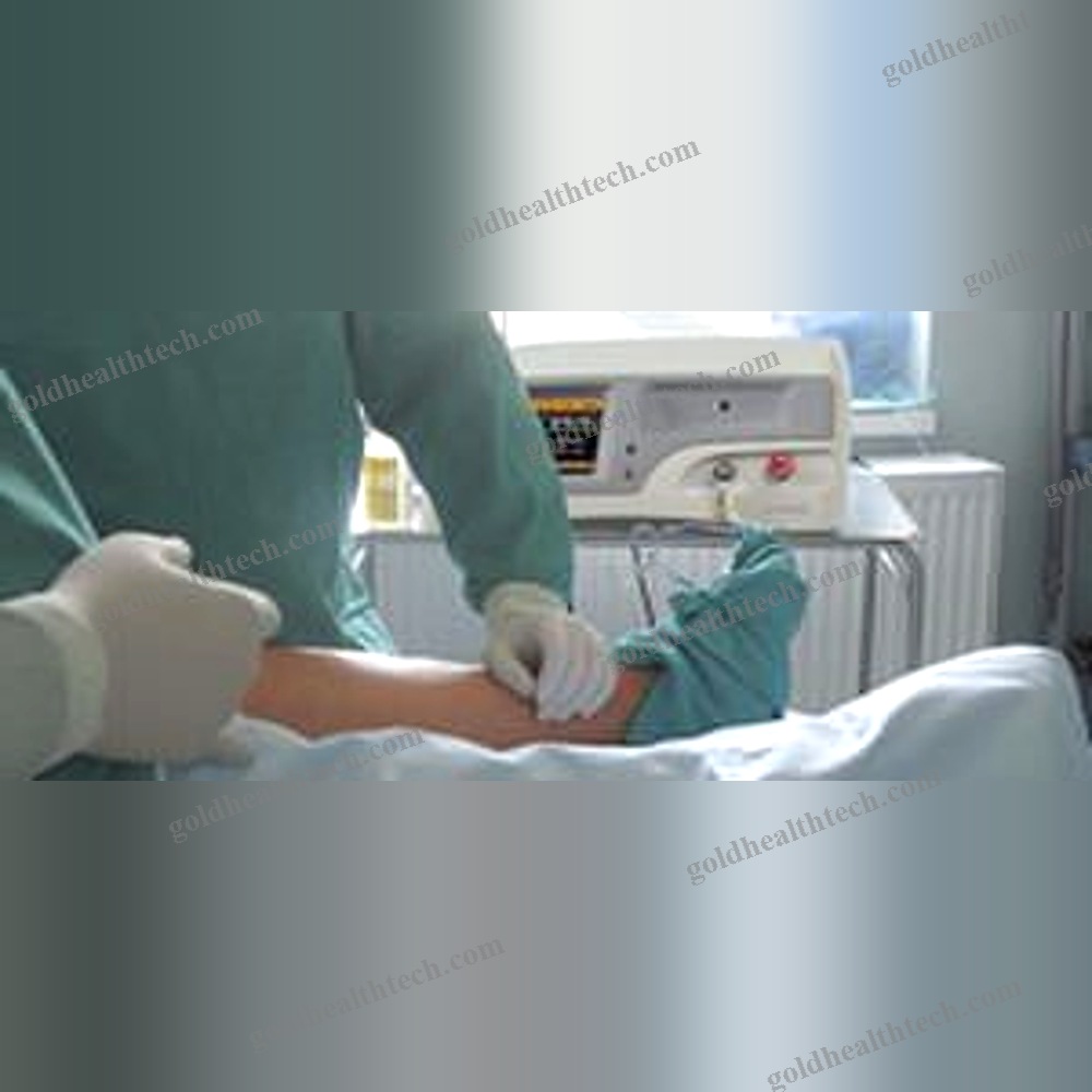 Gynecological Surgery Laser