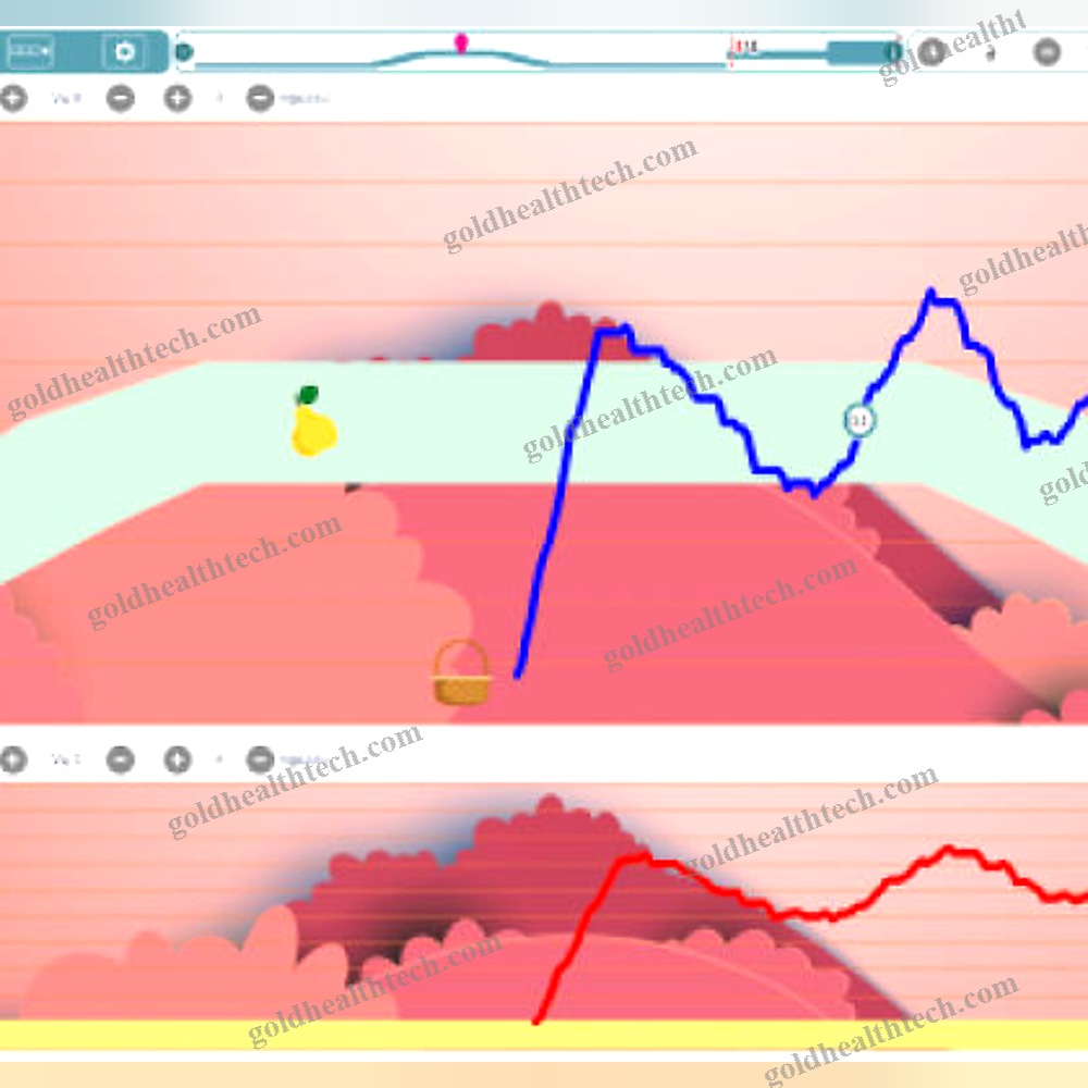 Pelvic Floor Stimulator