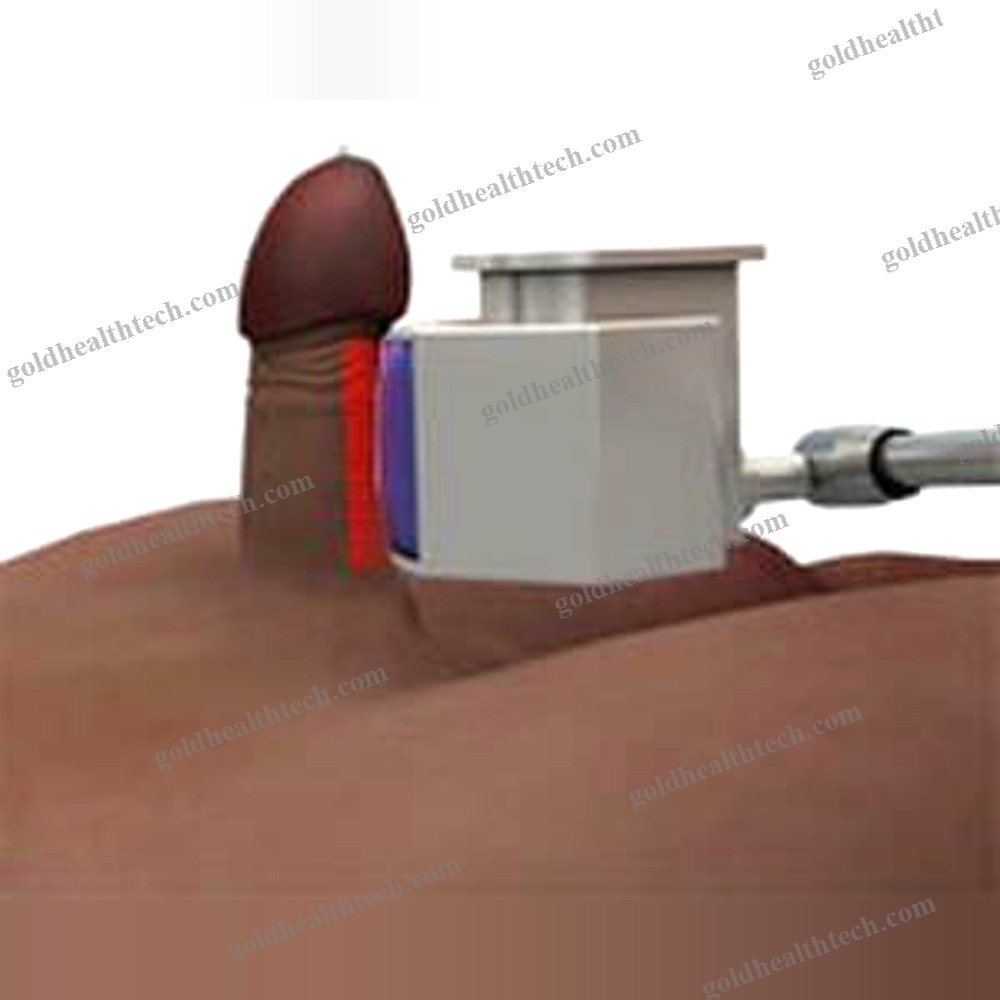 Erectile Dysfunction Eswt Unit