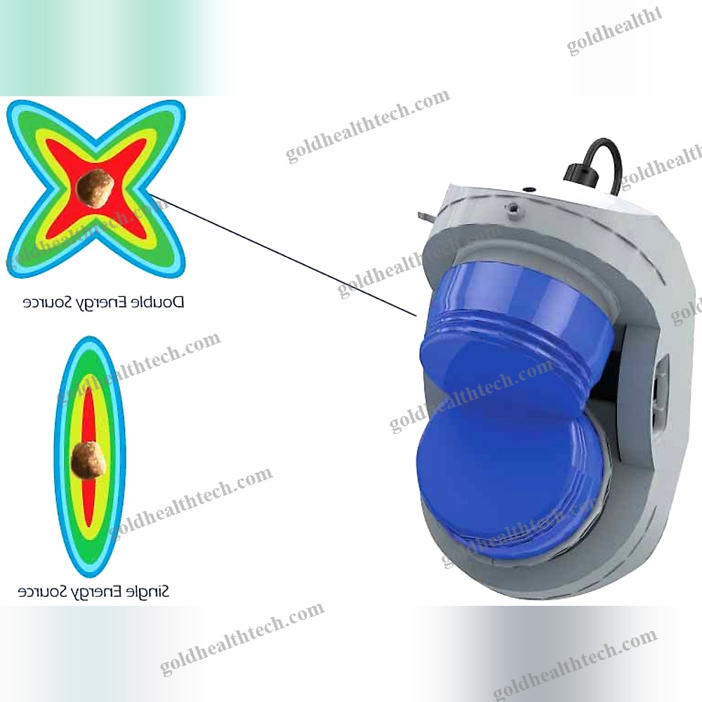 Extracorporeal Lithotripter