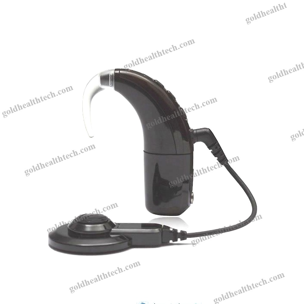 Behind-The-Ear Processor Cochlear Implant