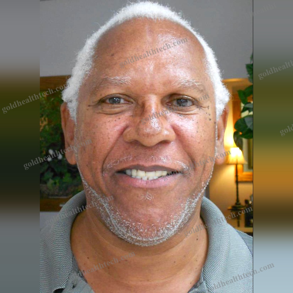Eye Cosmetic Prosthesis