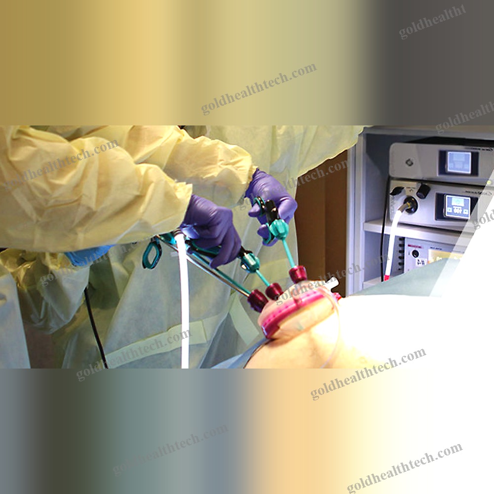Multi-Instrument Laparoscopic Port