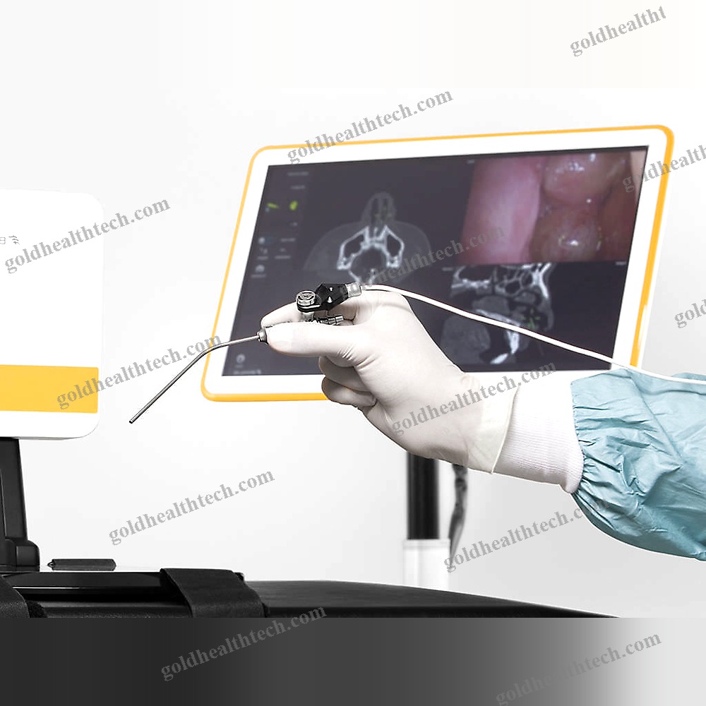 Ent Surgery Surgical Navigation System