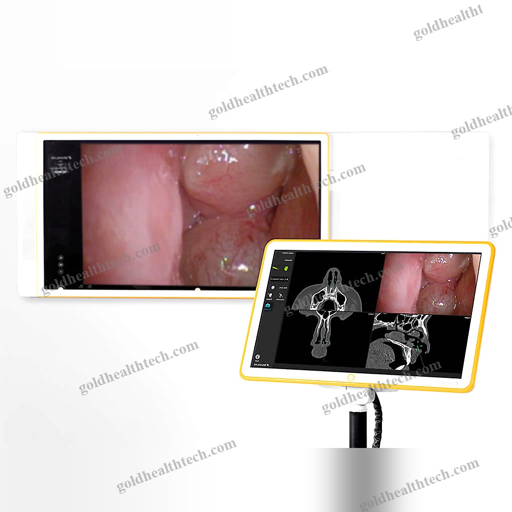 Ent Surgery Surgical Navigation System