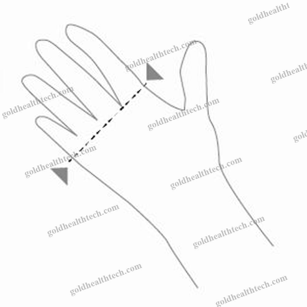 Palmar Resting Splint