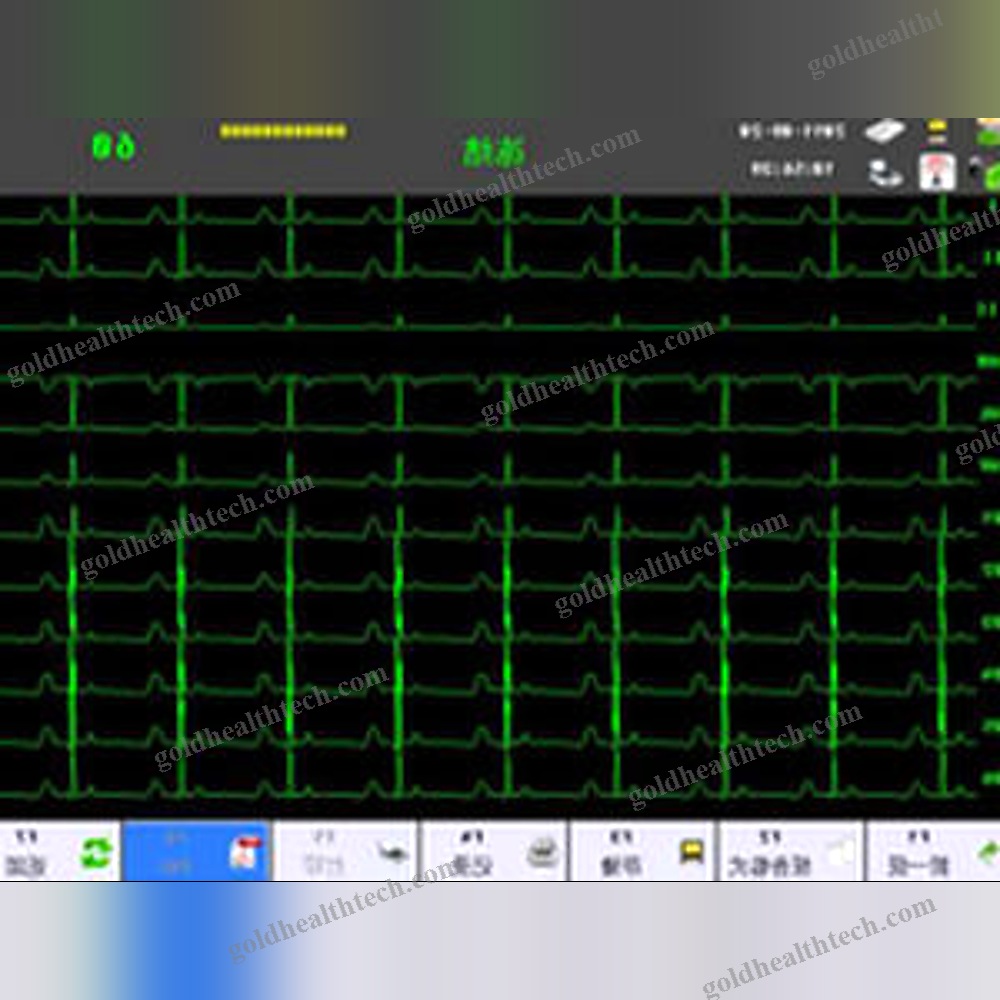 Resting Electrocardiograph