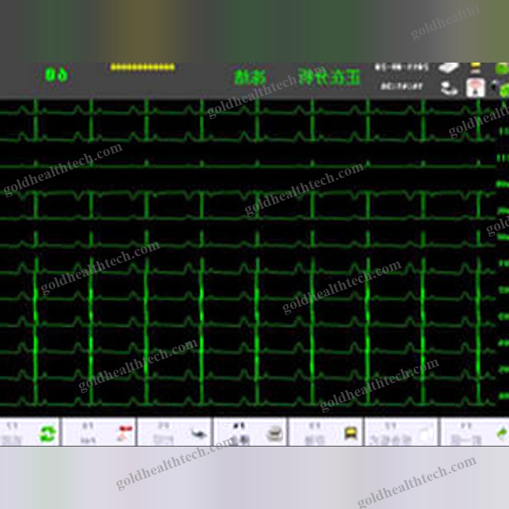 Resting Electrocardiograph