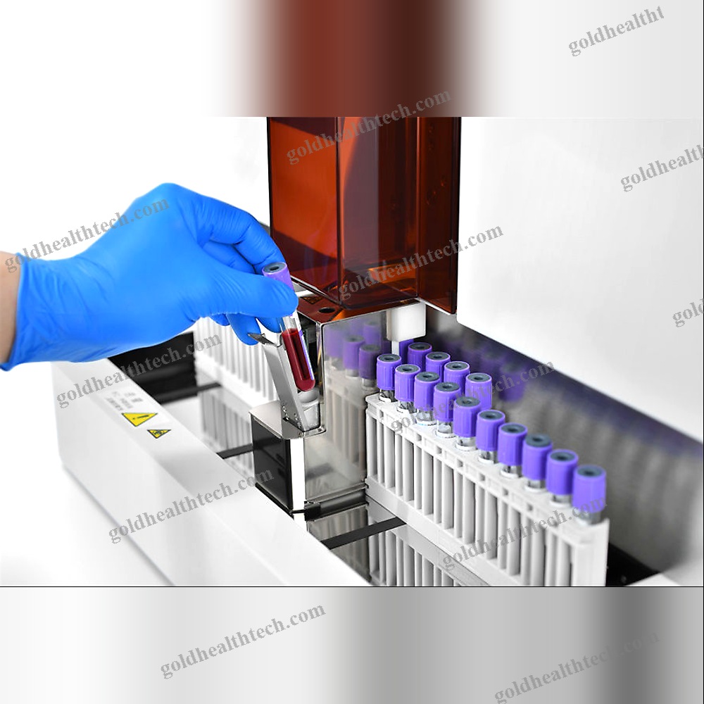 Automatic Hba1C Analyzer