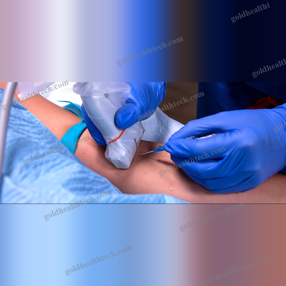 Ultrasound Probe Protective Cover