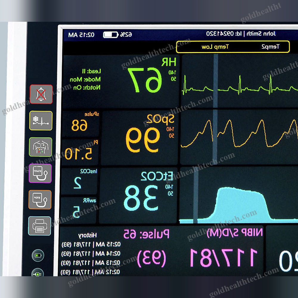 Portable Multi-Parameter Monitor