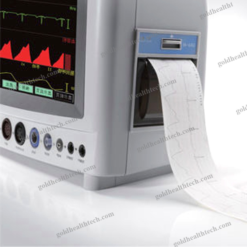 Trolley-Mounted Patient Monitor